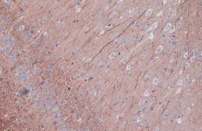 Immunohistochemistry-Paraffin: PKC epsilon [p Ser729] Antibody [NBP3-13312]